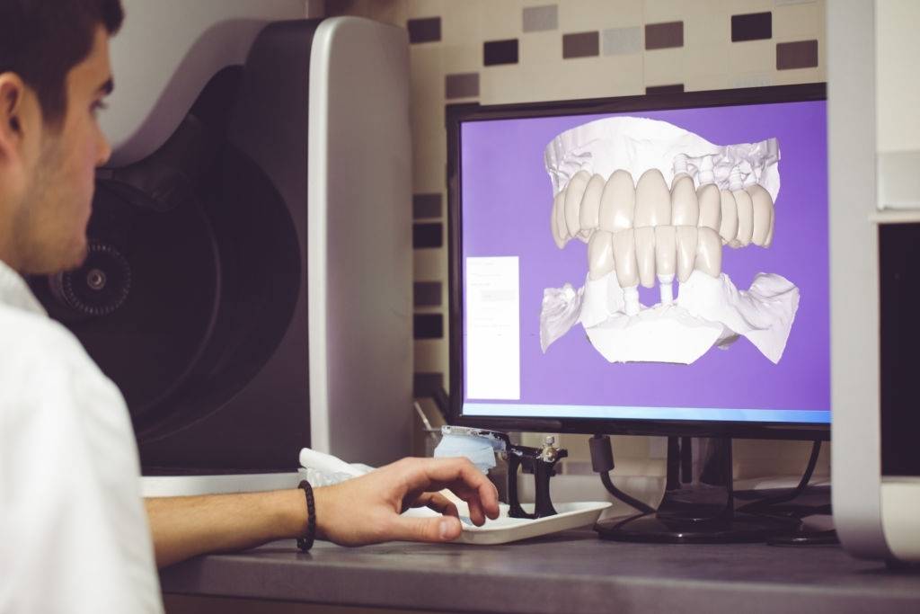 در حال طراحی سه بعدی ایمپلنت دندانپزشکی