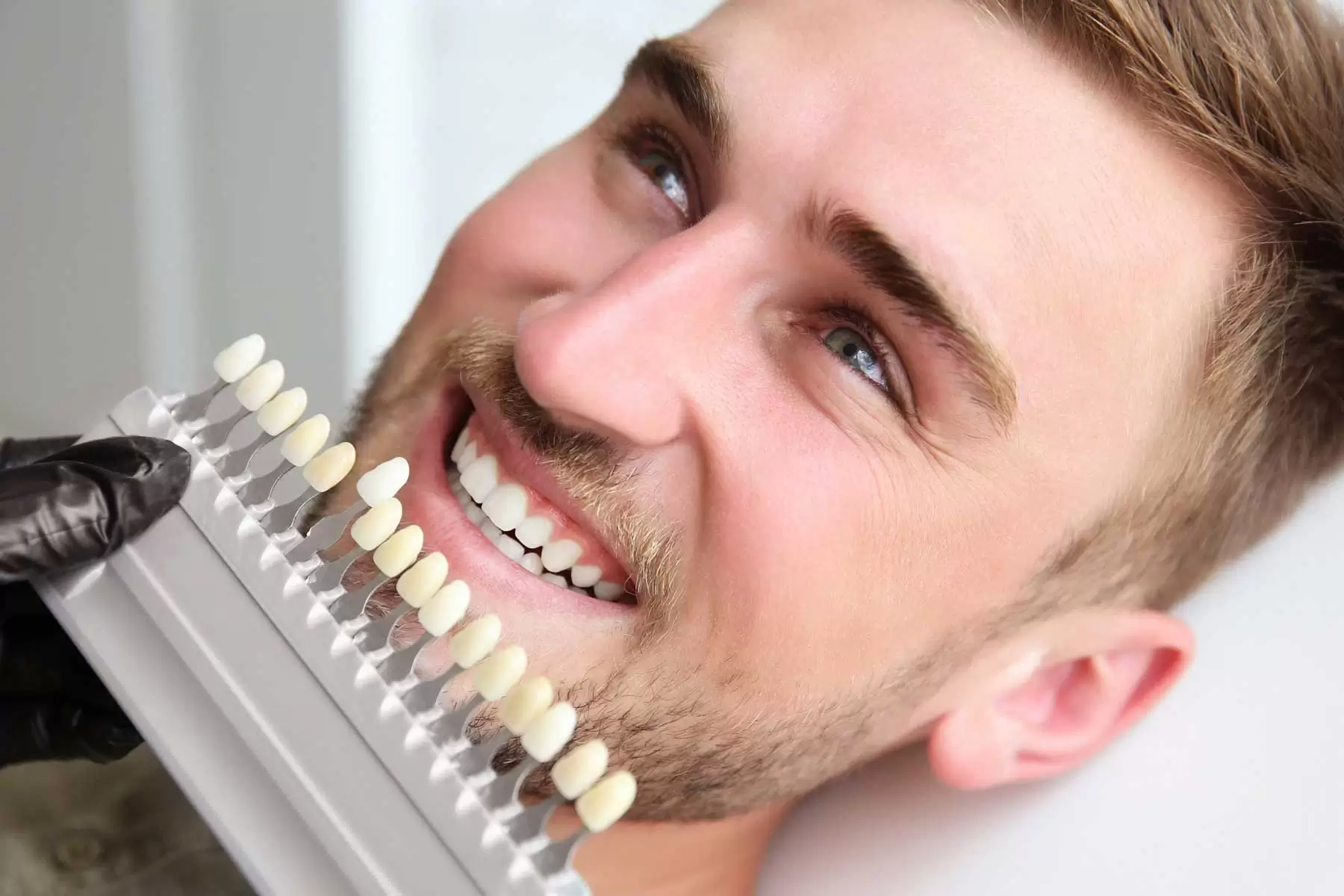 تعیین رنگ دندان مناسب با دندان شما
