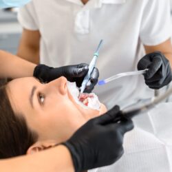 10 دلیل روشن برای دریافت خدمات سفید کردن دندان حرفه ای در کلینیک دندانپزشکی تاج