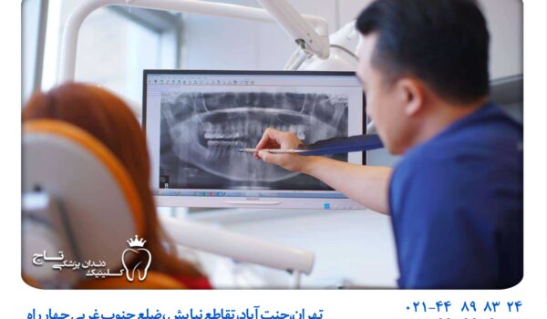 تصویربرداری دیجیتال دندان