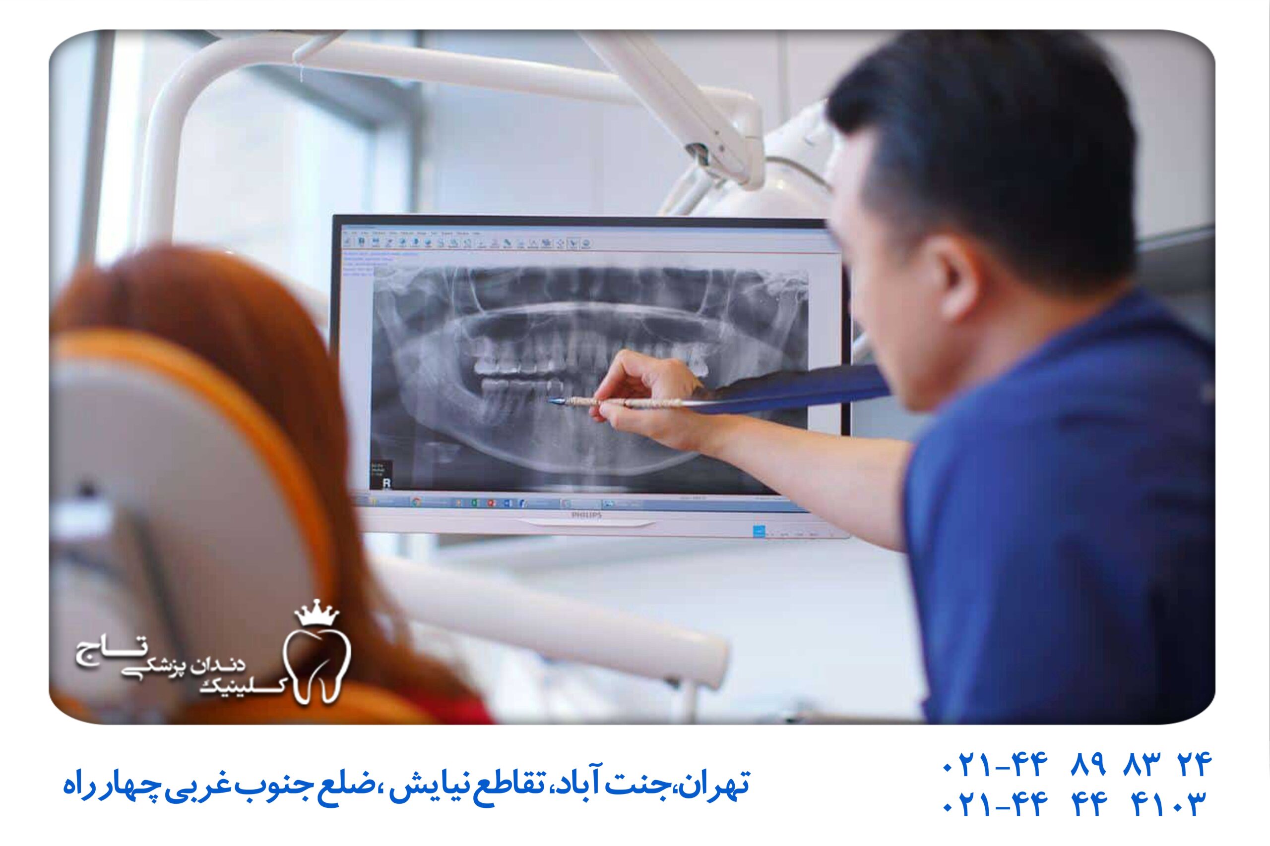 تصویربرداری دیجیتال دندان