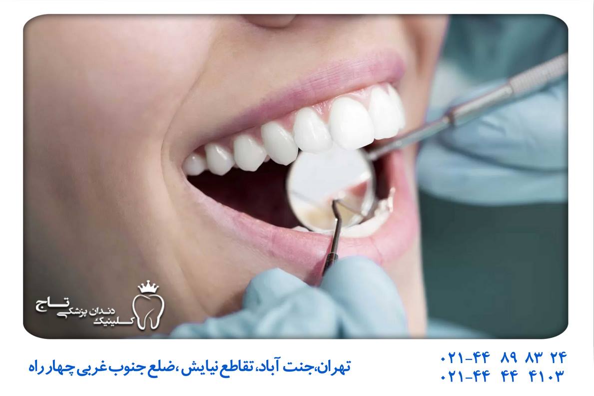 تصویر لبخند دندانپزشکی