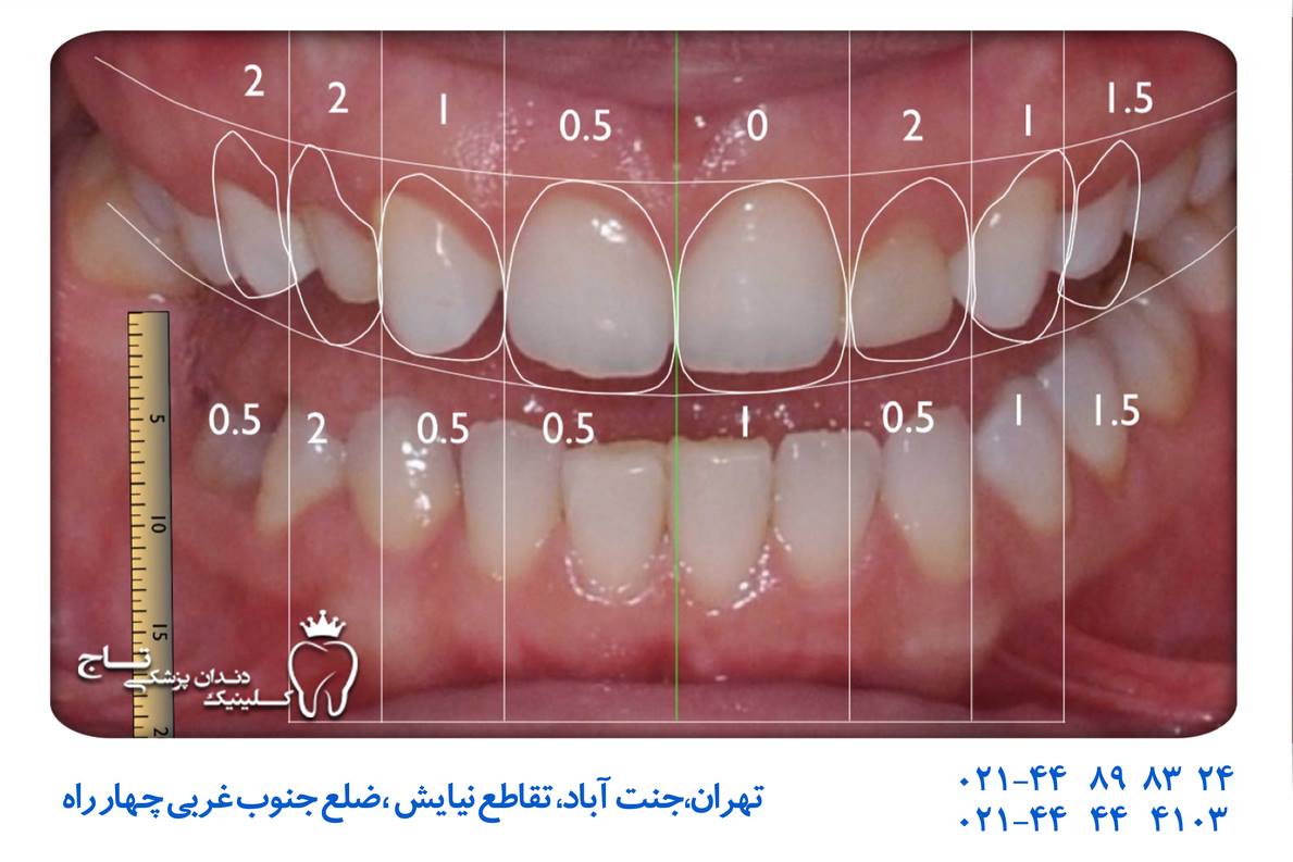طراحی دیجیتال لبخند دندانپزشکی
