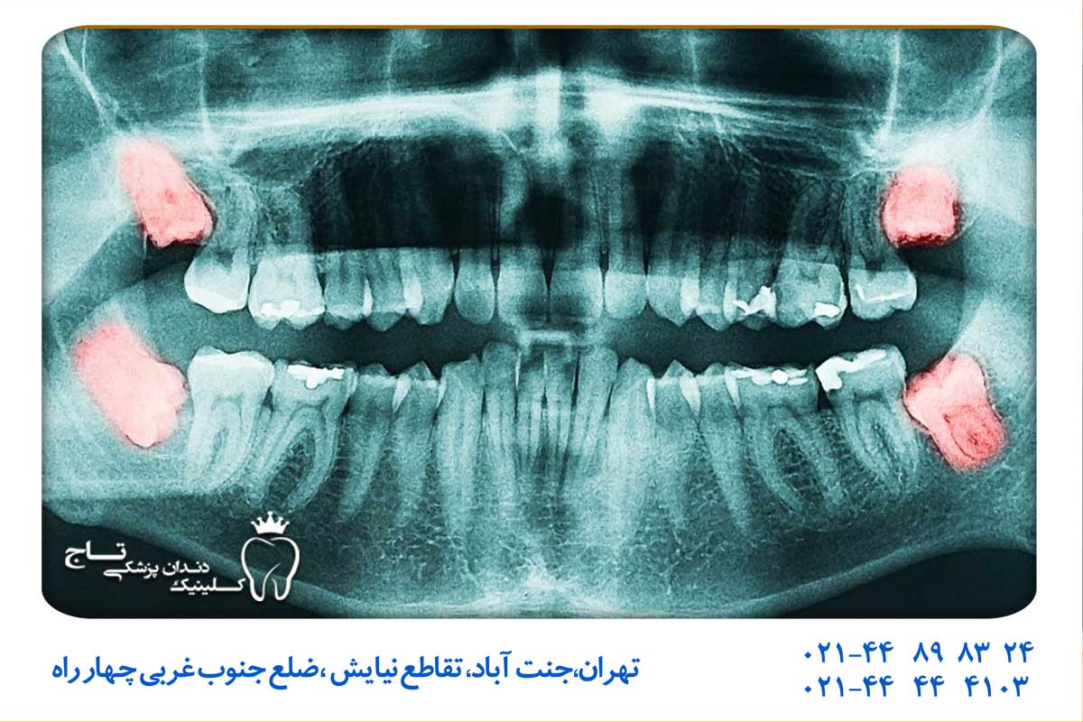 معاینه حرفه ای کلینیک دندانپزشکی 24 ساعته
