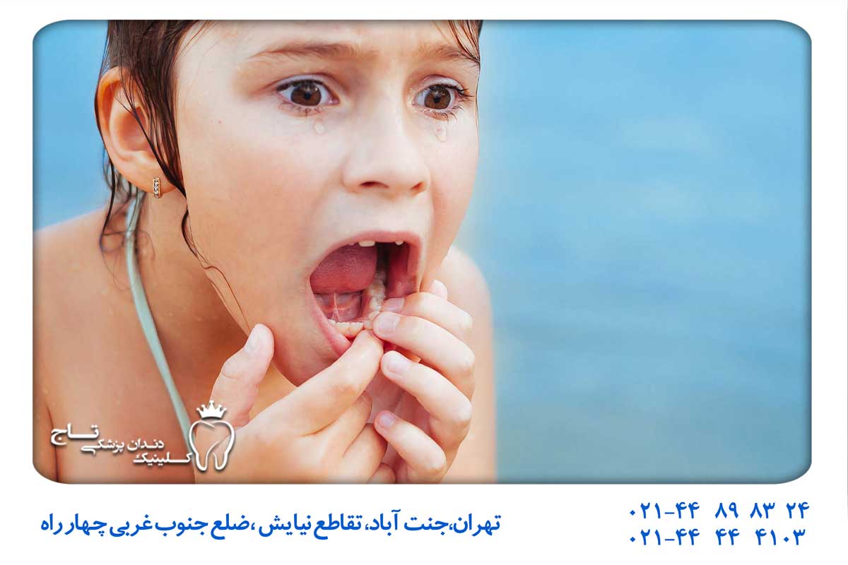 اورژانس دندانپزشکی اطفال