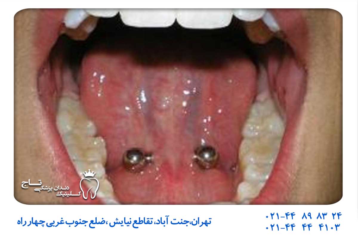 بهداشت و نگهداری دهان و دندان