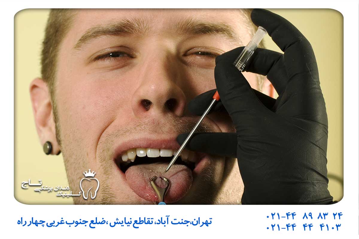 آیا پیرسینگ دهان دردناک است؟