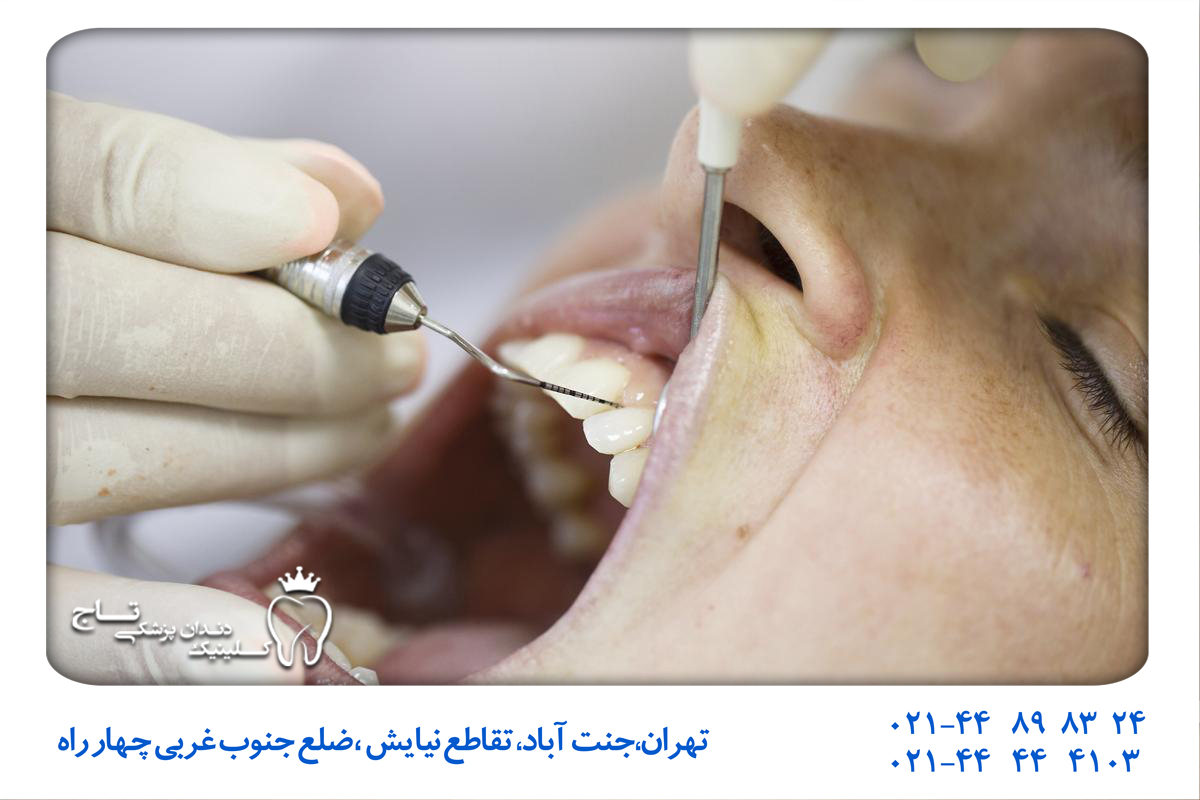 مزایای گزینه‌های درمان سریع بی دندانی
