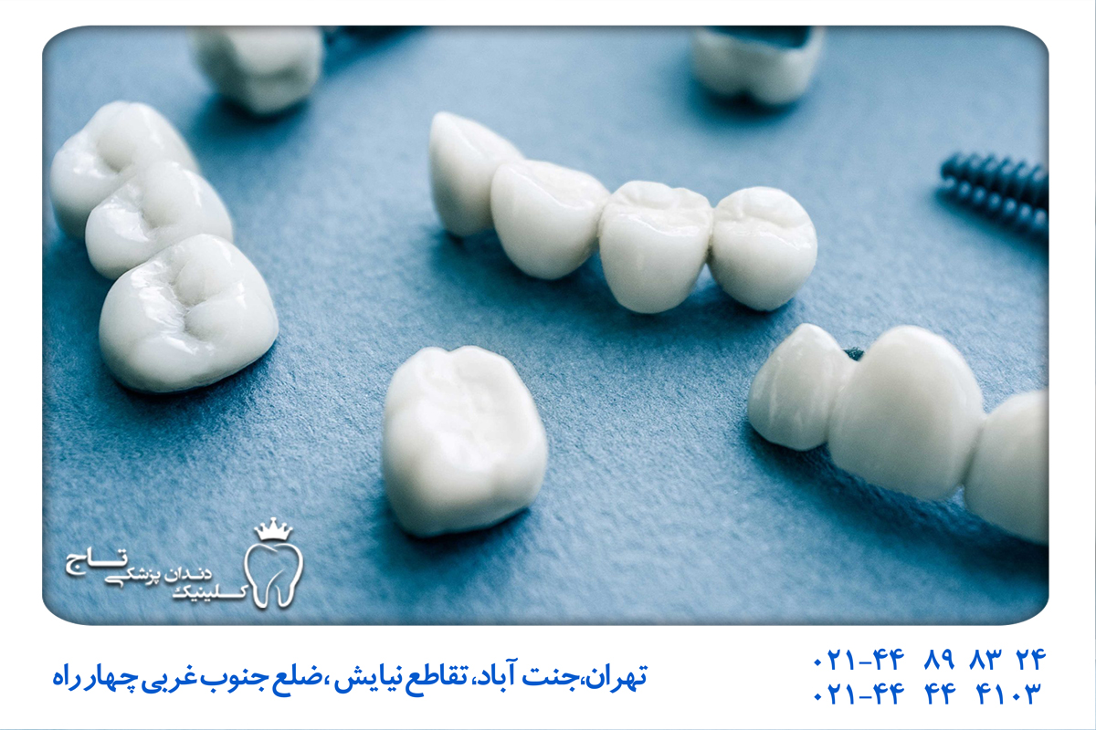 روش‌های سنتی برای جایگزینی دندان , درمان سریع بی دندانی