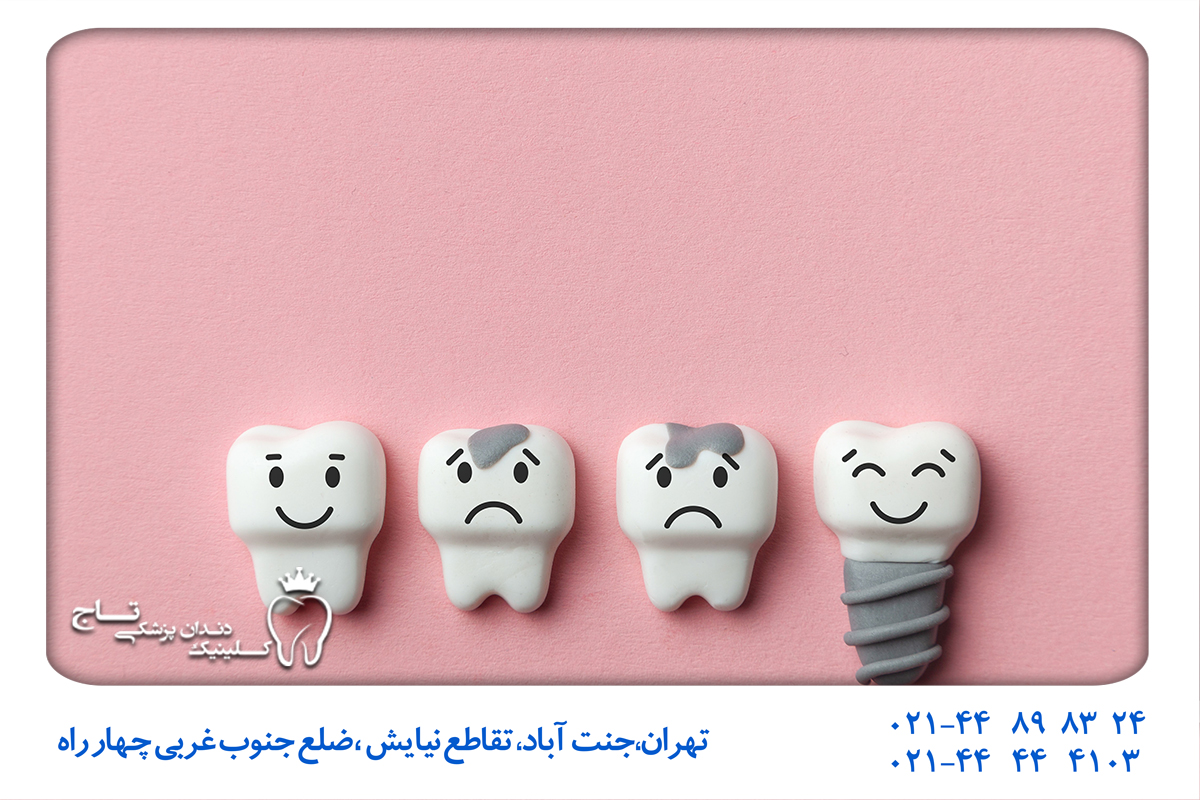 ملاحظات و محدودیت‌های درمان سریع بی دندانی