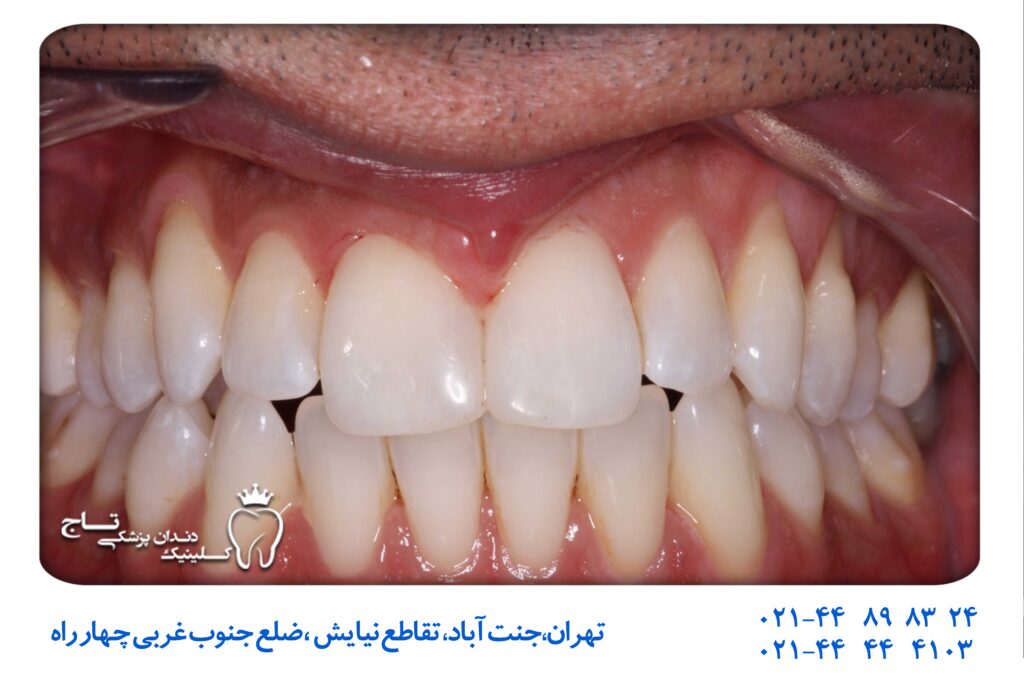دندانپزشکی اقساطی تهران