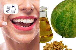 روغن حنظل برای دندان