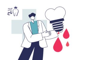 خونریزی بعد از ایمپلنت
