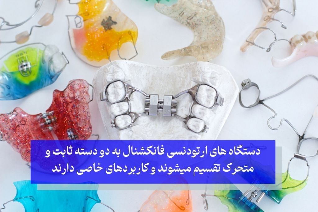 انواع دستگاه های ارتودنسی فانکشنال