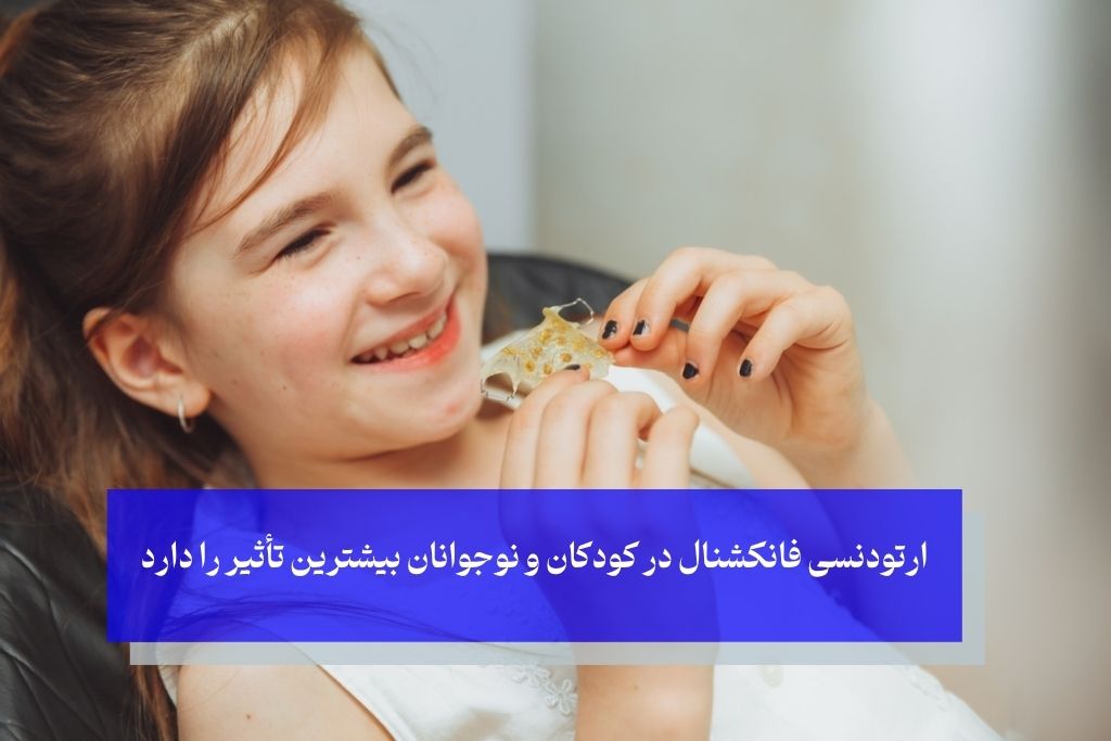 بهترین کاندیدای ارتودنسی فانکشنال
