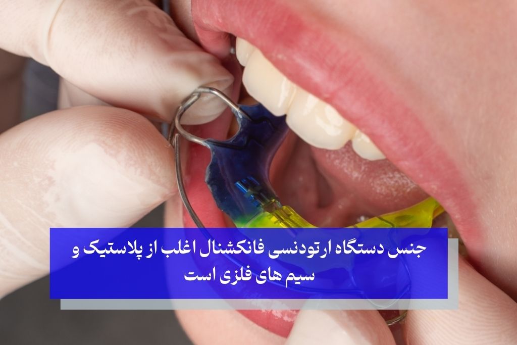 جنس دستگاه ارتودنسی فانکشنال