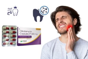 کپسول کلیندامایسین برای عفونت دندان