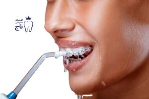 واترجت دندان