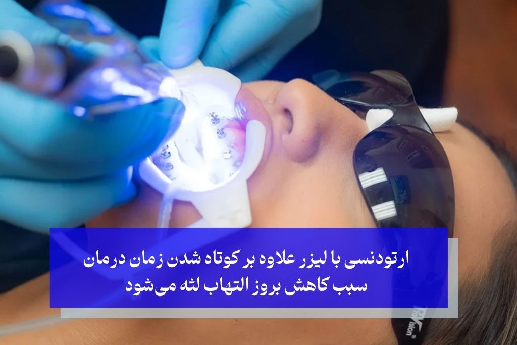 ارتودنسی با لیزر علاوه بر کوتاه شدن زمان درمان سبب کاهش بروز التهاب لثه میشود