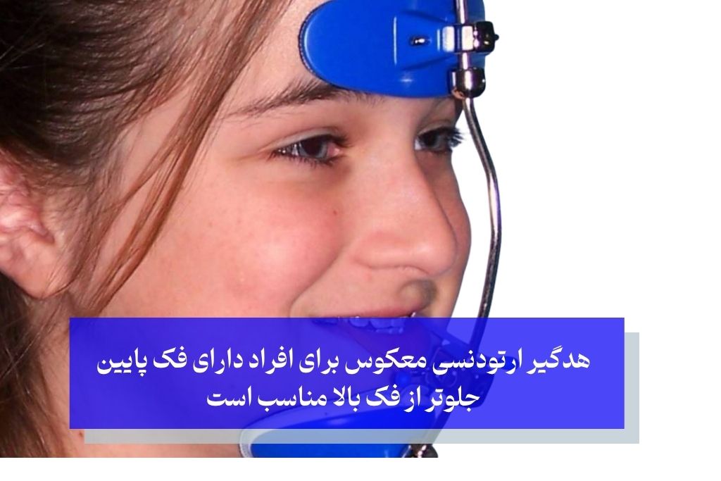 هدگیر ارتودنسی معکوس برای افراد دارای فک پایین جلوتر از فک بالا مناسب است