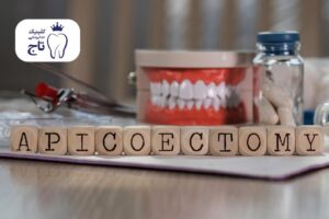 جراحی اپیکواکتومی