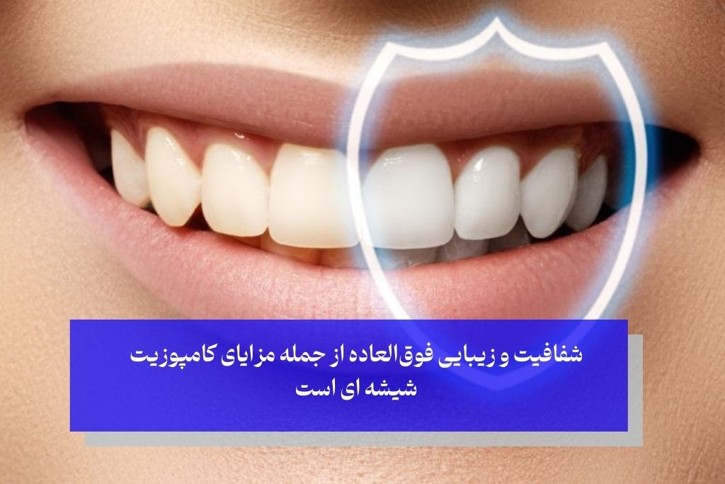 مزایا کامپوزیت شیشه ای