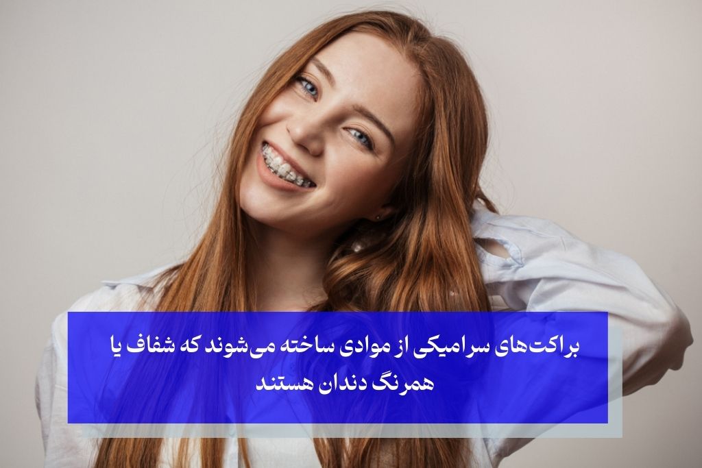 مزایای ارتودنسی سرامیکی