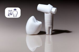 مینی ایمپلنت