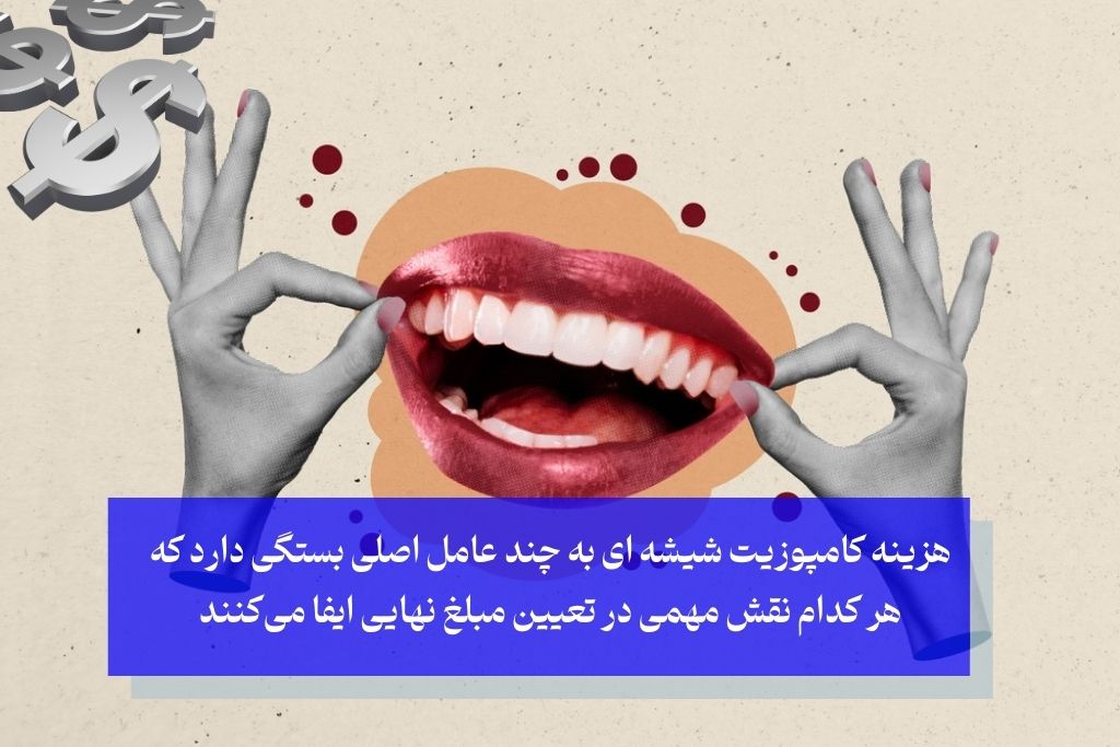 هزینه کامپوزیت شیشه‌ ای