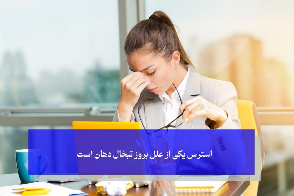 استرس و تبخال دهان