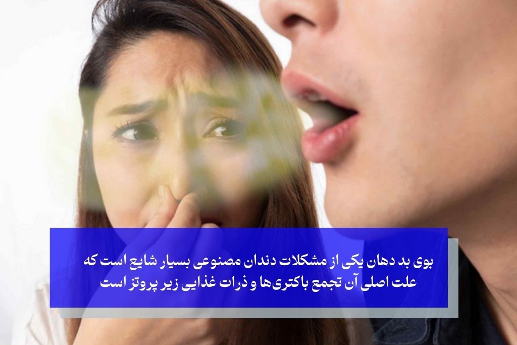 بوی بد دهان؛ یکی از مشکلات پنهان دندان مصنوعی