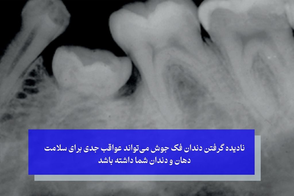 خطرات عدم درمان دندان فک جوش