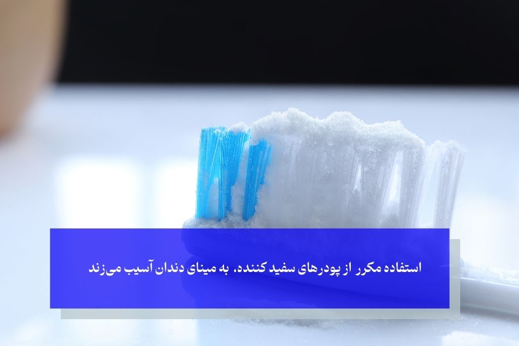 مزایا و بررسی عوارض پودر سفید کننده دندان