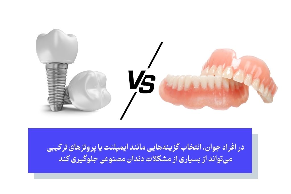 مشکلات دندان مصنوعی در افراد جوان