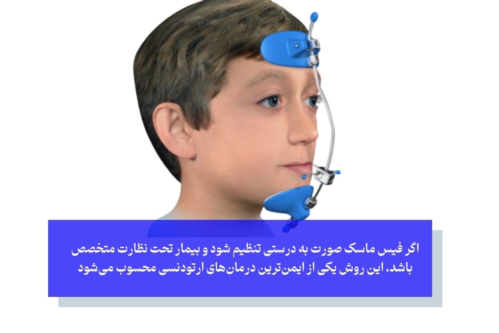 آیا فیس ماسک ارتودنسی ریسک دارد
