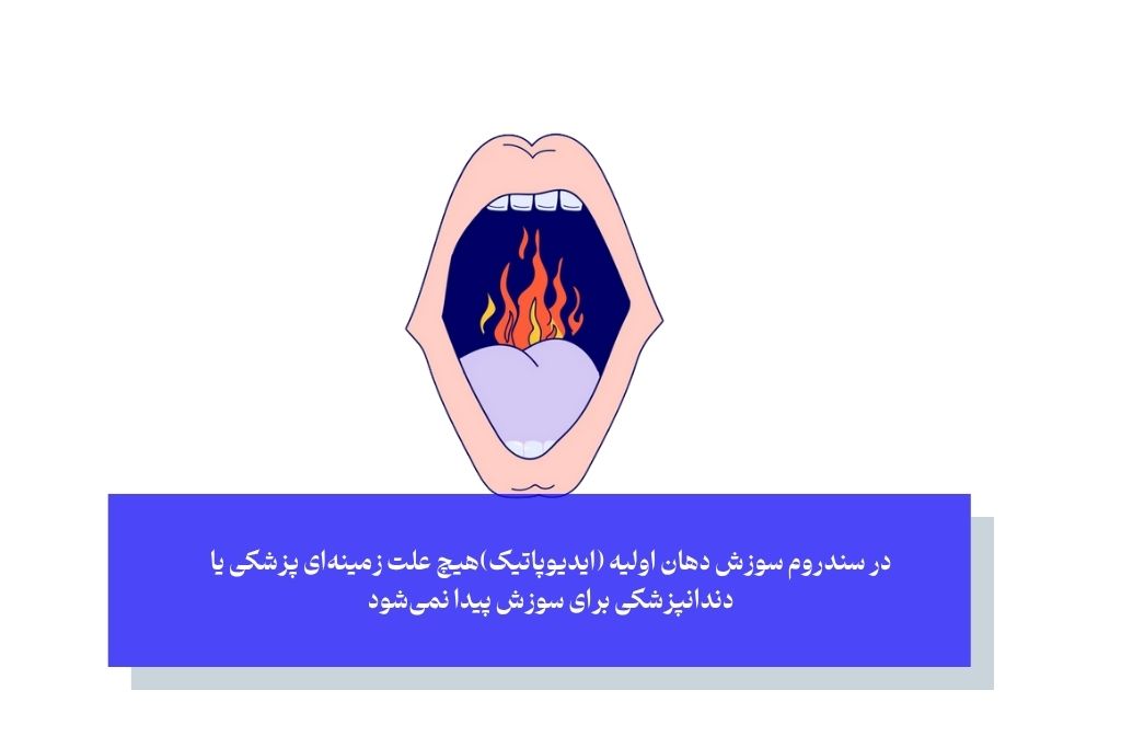 انواع سندروم سوزش دهان