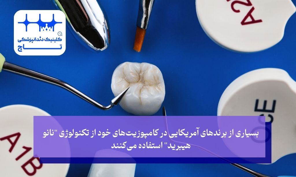 تفاوت‌های کلیدی کامپوزیت آمریکایی