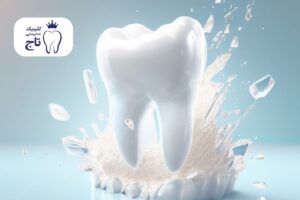 تقویت مینای دندان