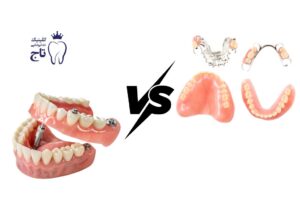 دندان مصنوعی ثابت بهتر است یا متحرک