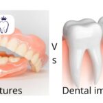 دندان چسبی بهتر است یا ایمپلنت