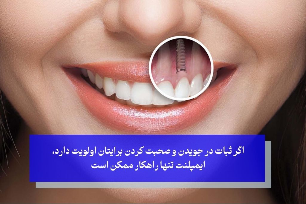 راحتی دندان چسبی بهتر است یا ایمپلنت