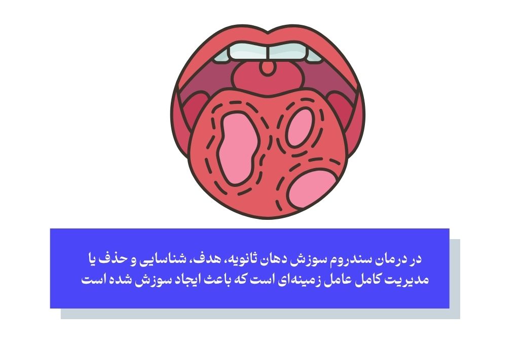 رویکرد درمانی برای سندروم سوزش دهان ثانویه؛ هدف‌گیری علت اصلی
