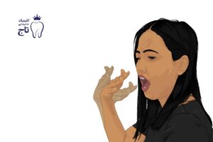 سندروم سوزش دهان