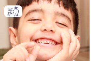 علت دیر افتادن دندان شیری