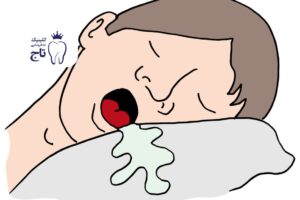 علت ریزش آب دهان