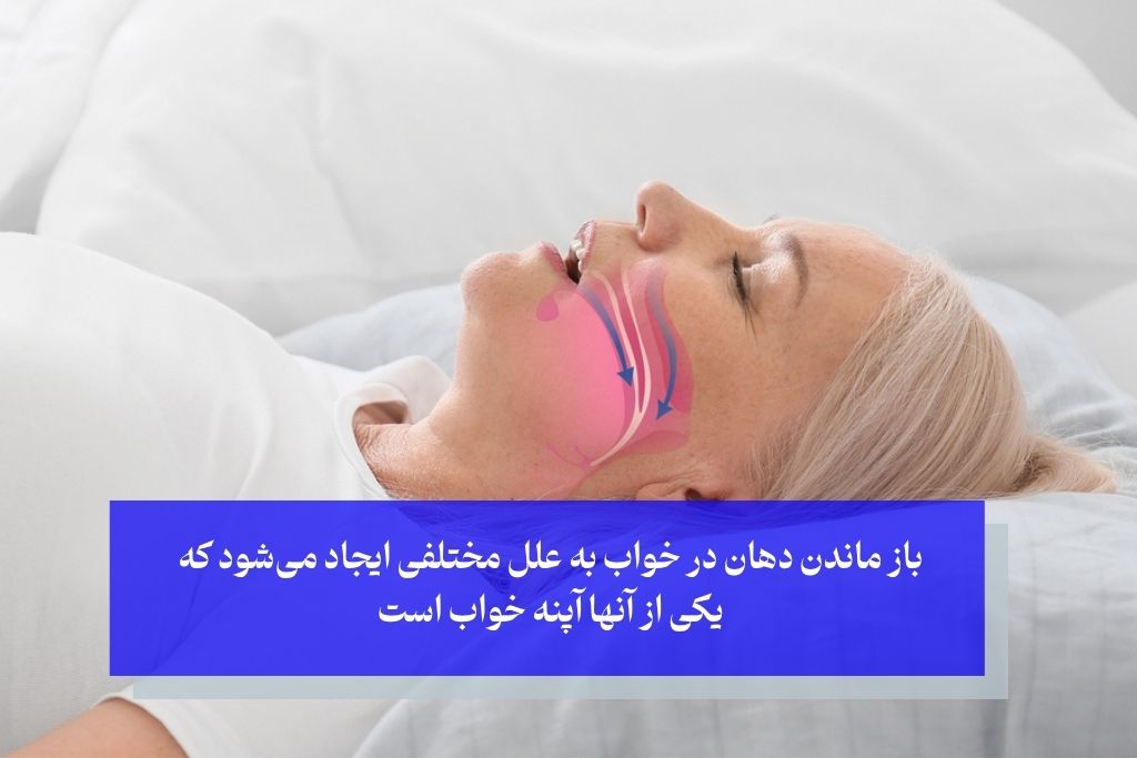 علل اصلی باز ماندن دهان در خواب