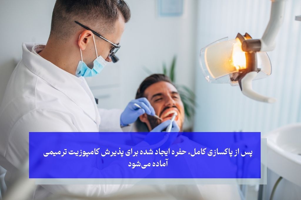 مراحل ترمیم دندان با کامپوزیت