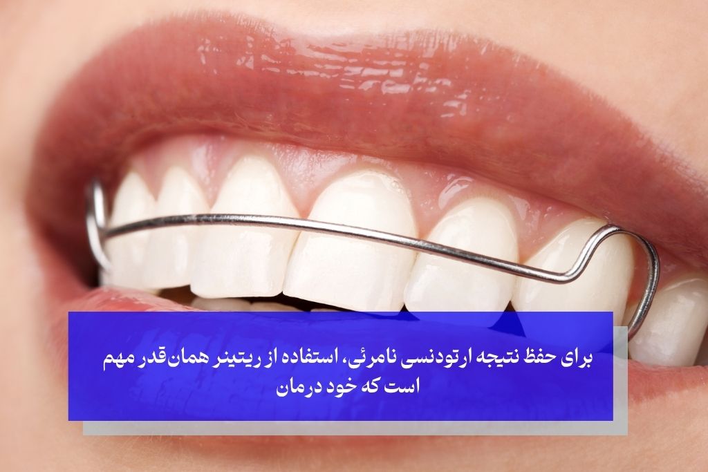 مراقبت‌های بعد از اتمام درمان ارتودنسی نامرئی