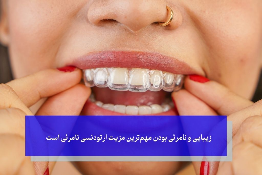 مزایا و معایب ارتودنسی نامرئی؛ یک نگاه صادقانه