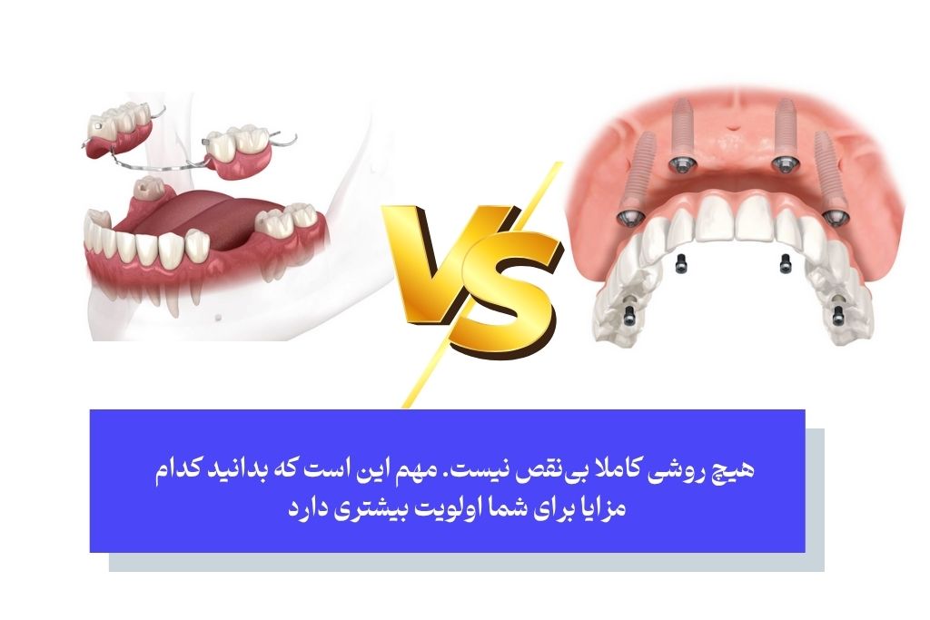 مزایا و معایب دندان مصنوعی ثابت و متحرک